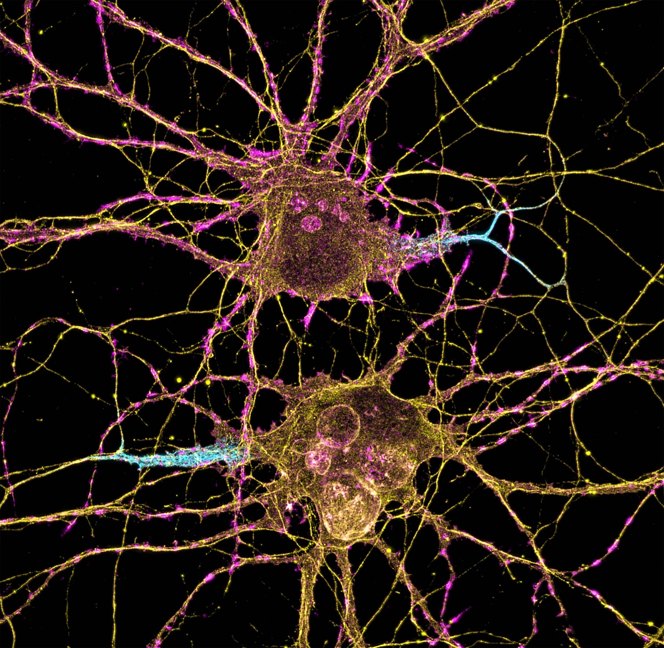 Fluorescence micrograph of two neurons with branching dendrites in yellow and magenta.