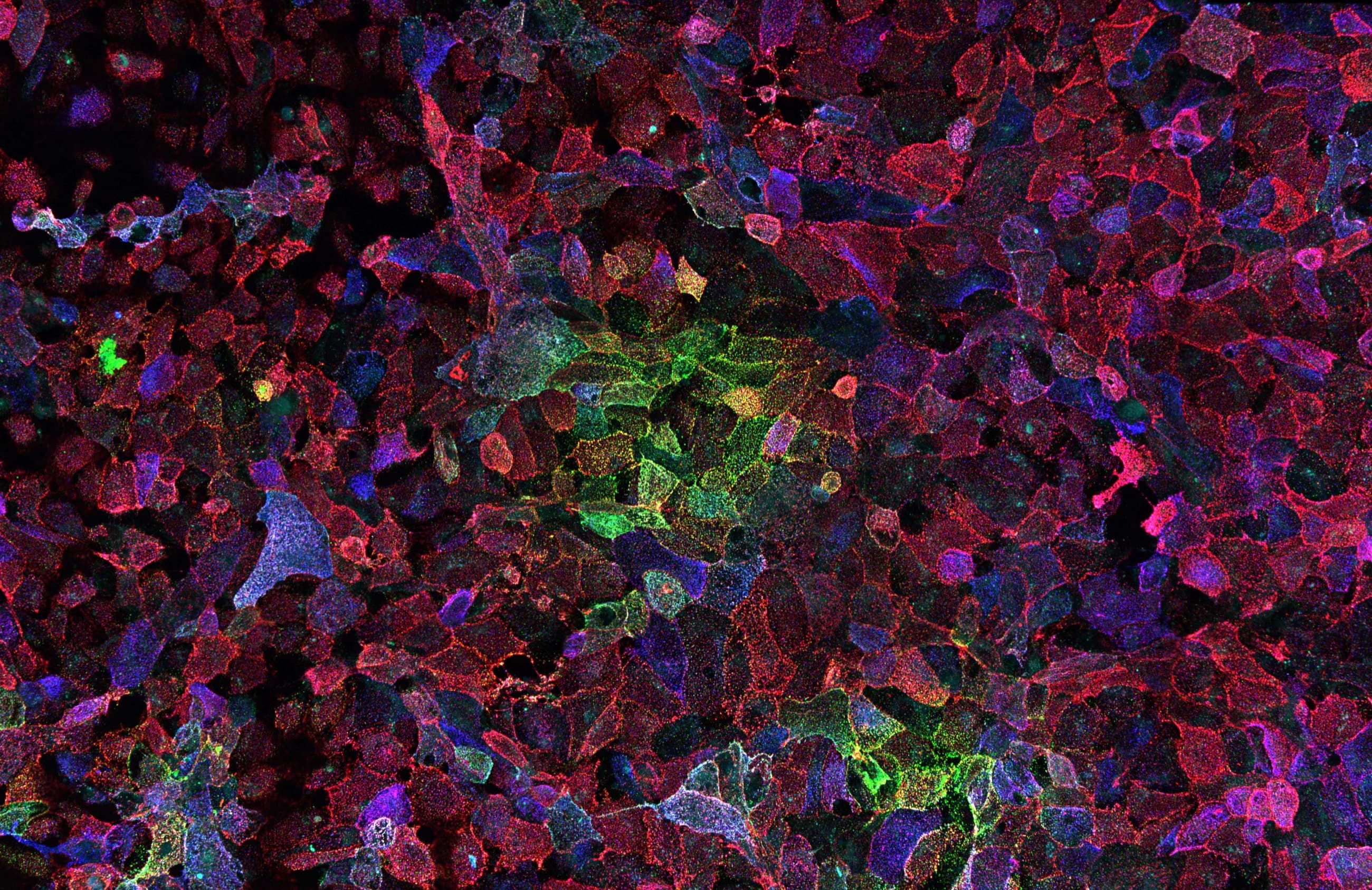 Fluorescence micrograph of a dense field of cells in red, blue, and green.